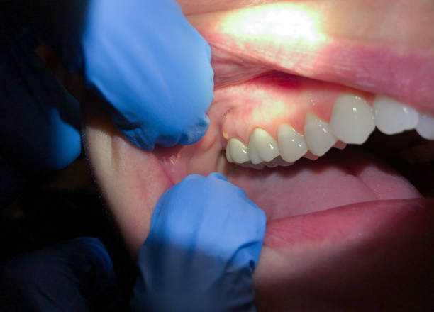 Best Emergency Tooth Extraction in Van Vleck, TX